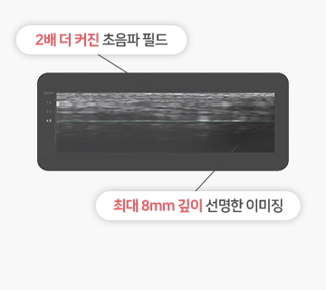 포인트 이미지